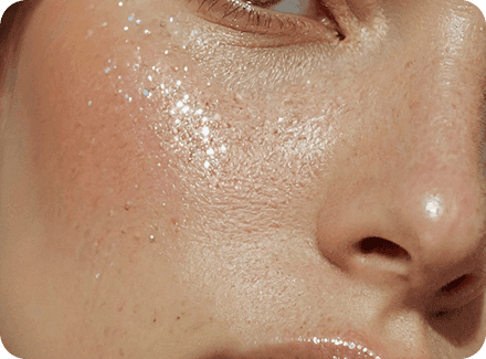 What My Acne Journey Taught Me About Confidence
